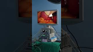 Stalwart FHD endoscopy camera system