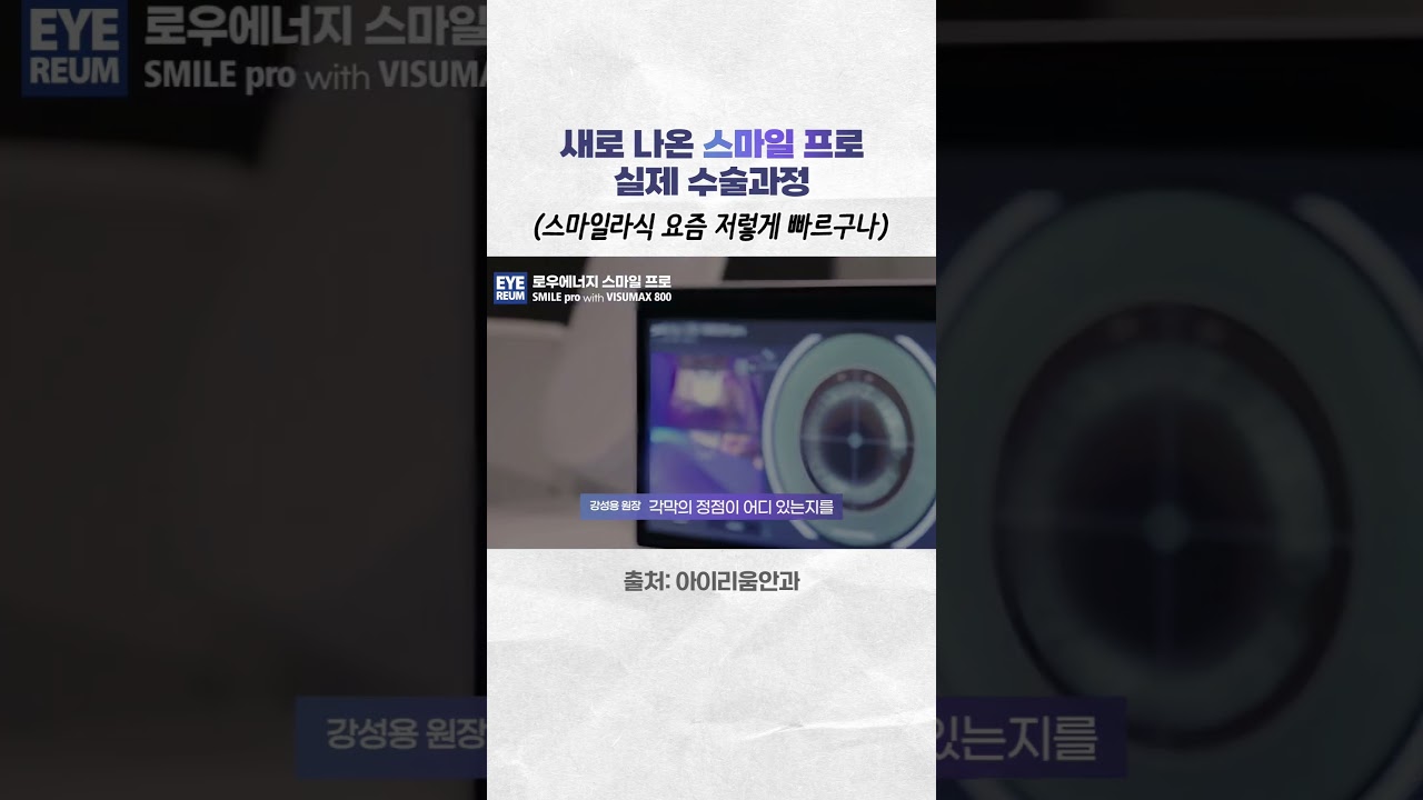 [艾利眼科診所] SMILE Pro 手術公開 [真實實況] – SMILE 雷射手術影片
