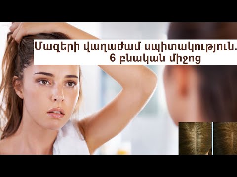 Video: Փորձագետը բացահայտում է տանը մազերի որակը բարելավելու էժան միջոց