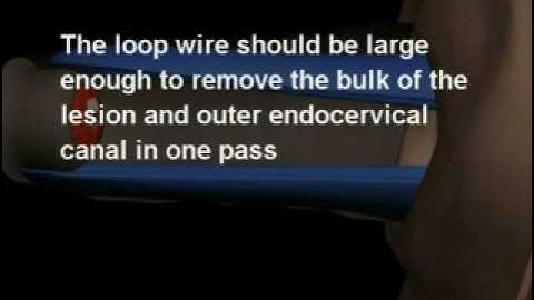 LEEP (sample) - www.proceduresconsult.com