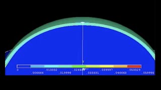 Prof Ziada Grand Round With Dr. Yasser Rifay: Mapping In Detection Of Early Kc Resimi