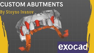 Fastest Exocad Video Tutorial - How To Design Custom Abutments