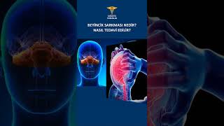 BEYİNCİK SARKMASI NEDENLERİ VE TEDAVİSİ