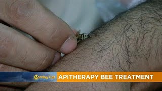Apitherapy Bee Treatment For Pain The Morning Call