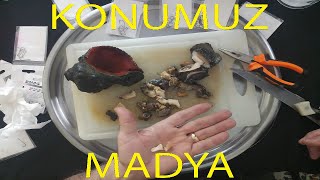 Download Lagu Madya Nedir Nasıl Kancaya Takılır MP3 Download Lagu Madya Nedir Nasıl Kancaya Takılır MP3