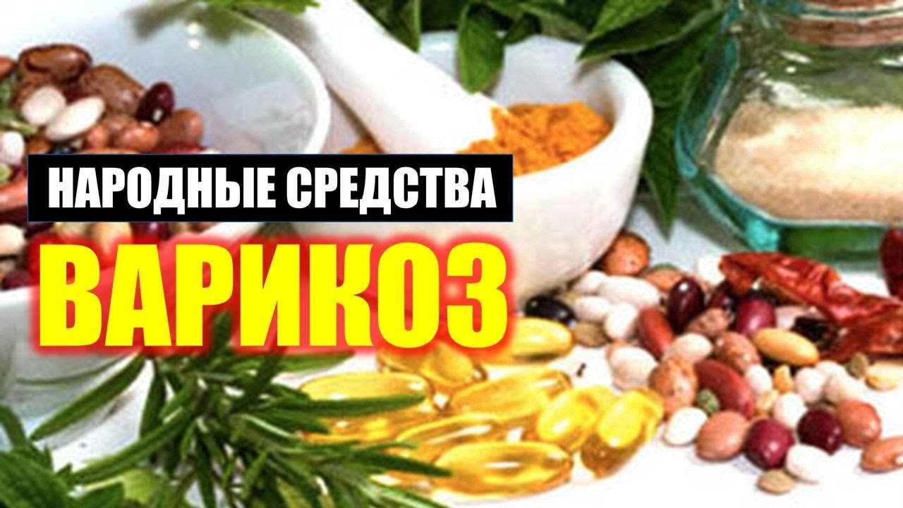 Как Лечить Варикоз на Ногах У Мужчин Народными Средствами. Лечение и ...