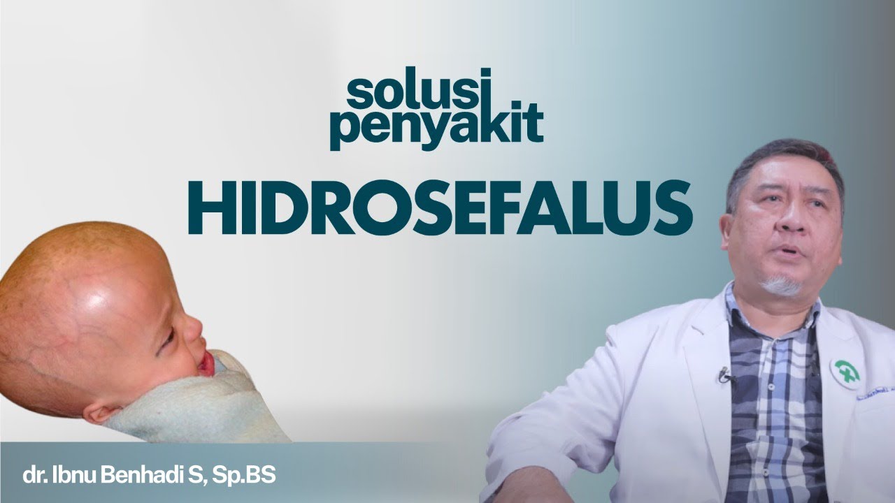 Hidrosefalus: Gejala, Penyebab dan Cara Mengatasi | Kata Dokter#167