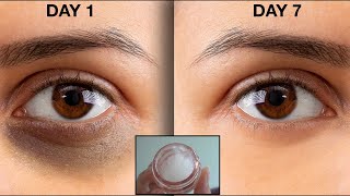 DIY Eye Cream to Get Rid of Under Dark circles &amp; Eye Wrinkles in just 7 Days