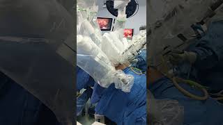 Robotic TLH surgery is running #reels #hospital #sauravjoshivlogs #doctor