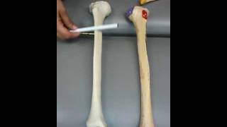 Tibia Landmarks