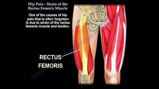 Hip Pain, Strain Of The Rectus Femoris, anatomy of the rectus femoris.