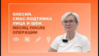 Олесия. СМАС-подтяжка лица и шеи. Месяц после операции