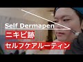 セルフダーマペンVlog【10月スキンケアルーティン】