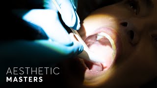 Laser Snoring Treatment: What Could It Do To Your Breathing? screenshot 1