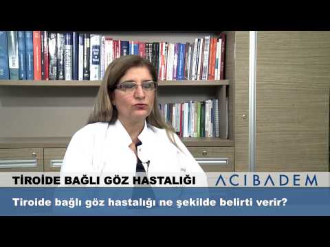 Tiroide bağlı göz hastalığı ne şekilde belirti verir?