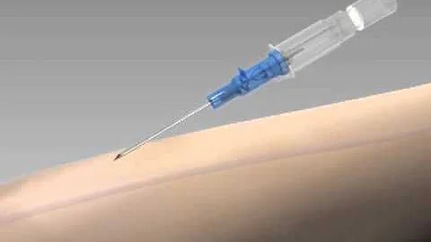 Introcan Demonstration