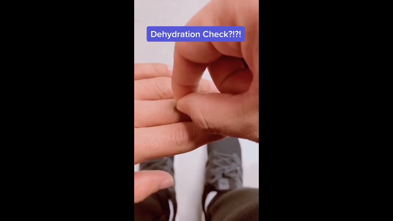 How To Tell If You Re Dehydrated Shorts Dehydration