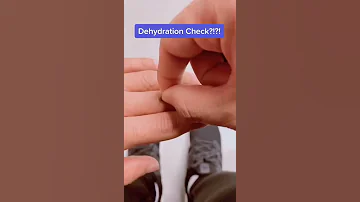 How To Tell If You Re Dehydrated Shorts Dehydration 