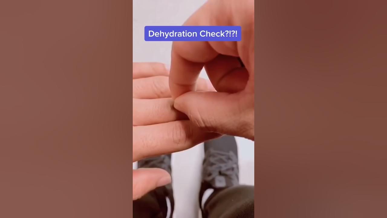 How to Tell If You’re Dehydrated? #shorts #dehydration