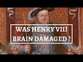 WAS HENRY VIII A BRAIN DAMAGED KING? | Henry VIII’s jousting accidents | Tudors | History Calling