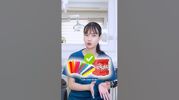 Tất tần tật những loại mắc cài khi niềng răng #shorts