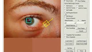 Vector Field Design on Surfaces
