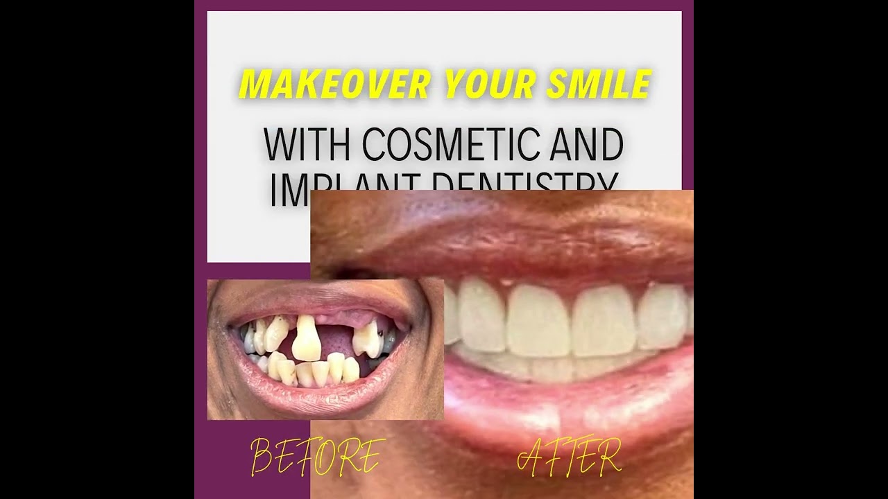 We are being featured on Dental Watch! Check it out!!