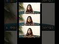 Bridal Smile Makeover in Kochi | Dental Point Orthodontic &amp; Root Canal Centre