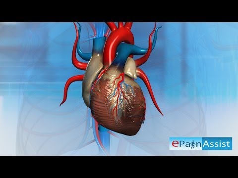 Heart Attack-What Can Cause A Heart To Stop Beating?