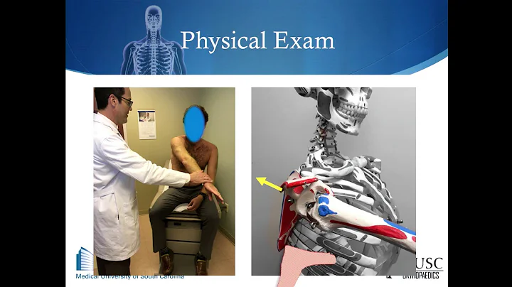 Diagnosis and Treatment of Posterior Instability