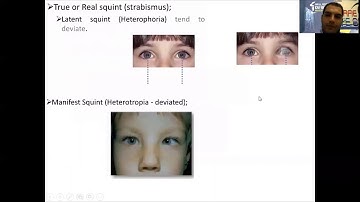 Clinical Round  Strabismus classification