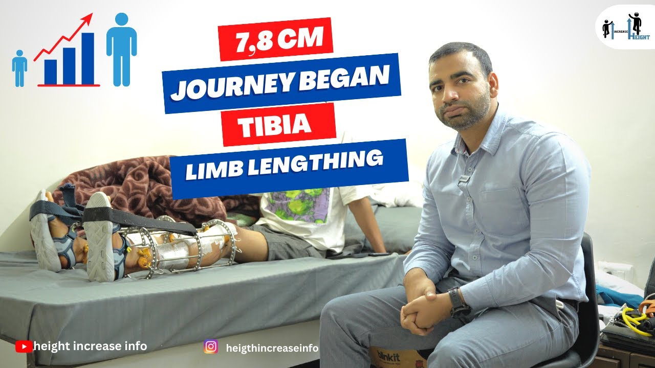 #limblengtheningsurgery 7.8cm journey began tibia Limb lengthening # ...