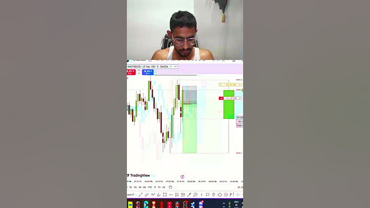 this TRADER is insane #shorts #Trading #DayTrading #TechnicalAnalysis #FYP #Viral #financialfreedom