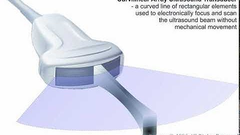 Curvilinear (Convex) Array Ultrasound Transducer - Principle of Operation ANIMATION