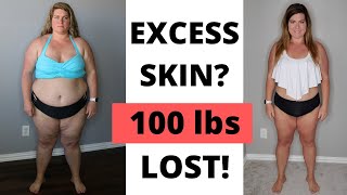 Week 48 Keto Transformation │Excess Skin After 100 Pound Loss?
