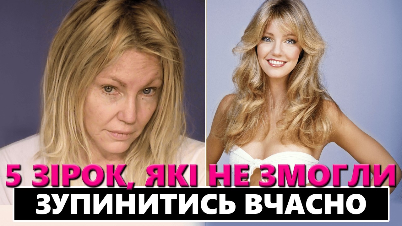 ЗНАМЕНИТОСТІ, ЯКІ ВТРАТИЛИ ВСЕ | ТОП 5 ЗІРОК, яких ми пам'ятаємо з дитинства та юності (доповнене)