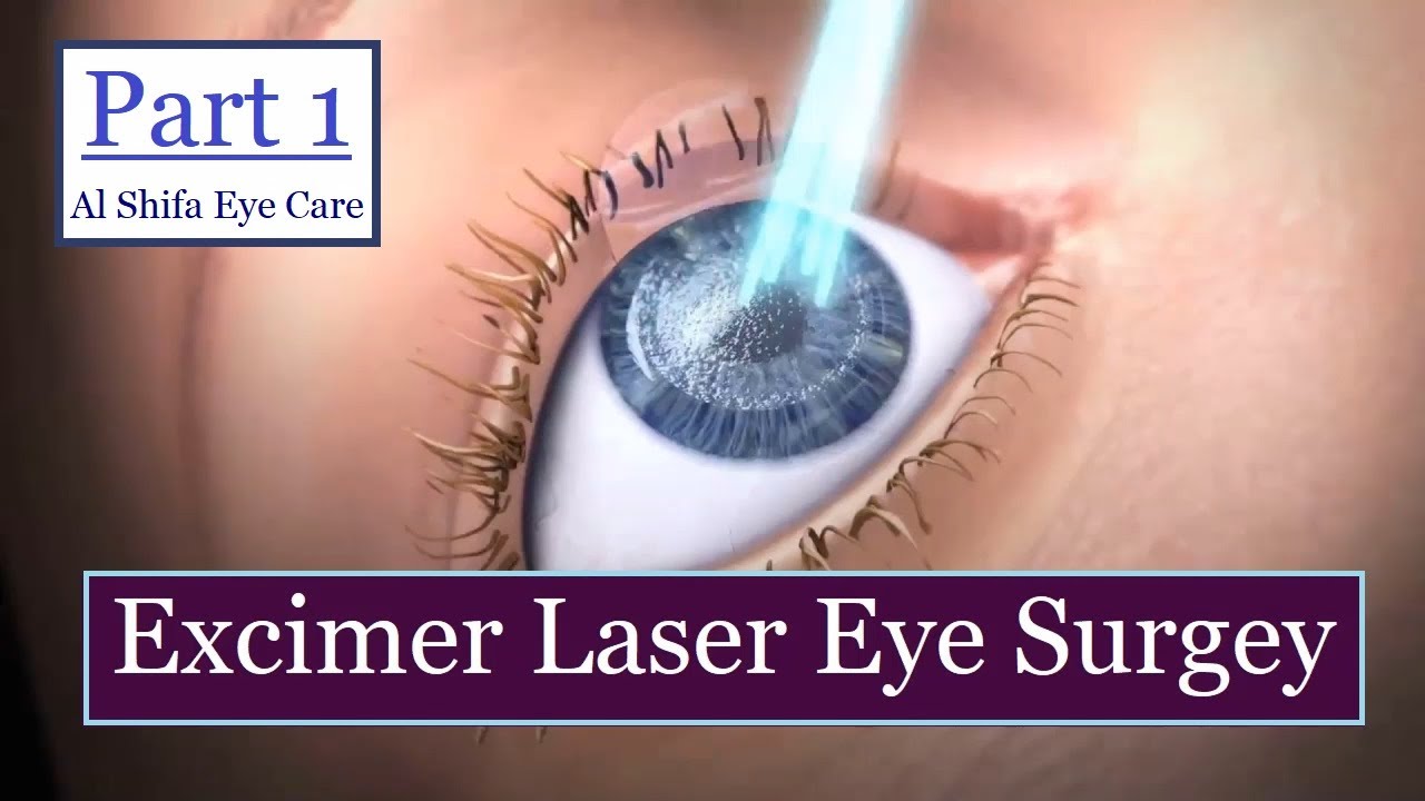 Лазерная коррекция зрения 2024. Эксимерный лазер в офтальмологии. Эксимер-лазерная коррекция зрения. Лазерная операция на глаза. Глаза после лазерной коррекции зрения.