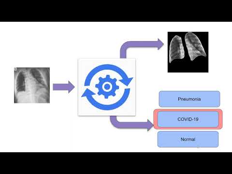 Automated Radiography Analysis Framework Using Deep Learning for Lung Infection Identification