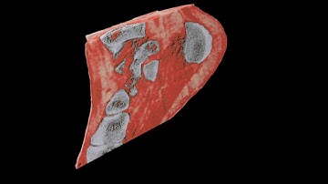 3D Color X-Rays Now Possible Thanks To CERN Technology