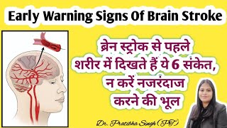 Early warning signs of Brain Stroke (Paralysis) | ब्रेन स्ट्रोक होने से पहले के 6 जरूरी संकेत