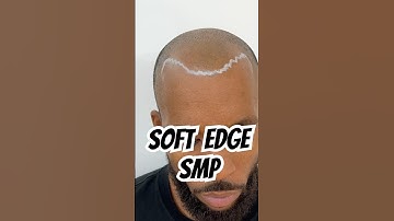 No Hard Lime Scalp Pigmentation