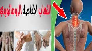 في ١٠دفائق فقط تخلصي من التهاب المفاصل والروماتيزم  علاج المفاصل والعظام / علاج الم العمود الفقري