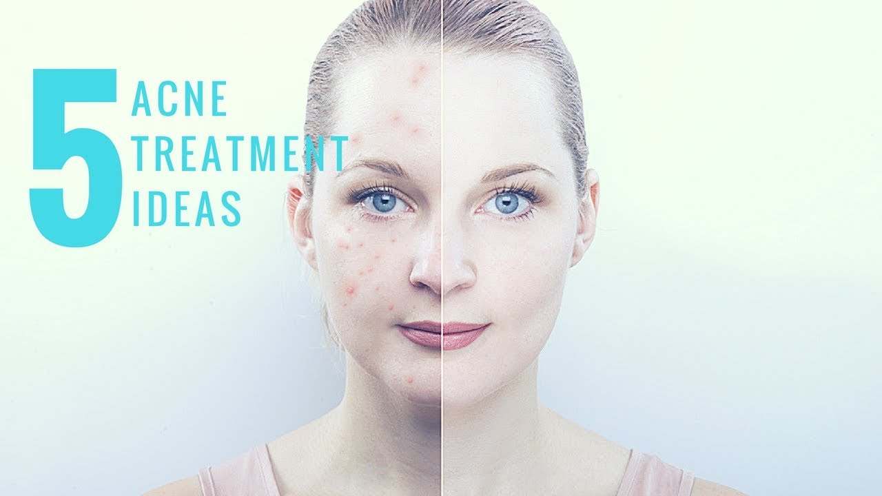 Заблюрено лицо. Лицо косметология. Девушка с проблемной кожей. Состояние кожи