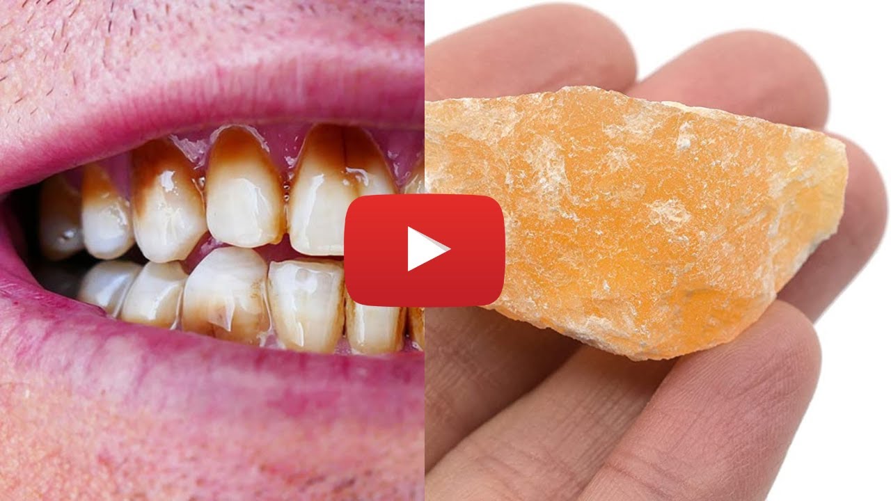 Click this video to learn how to repair the damage in your gums caused by gum disease. YouTube