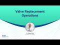 Valve replacement operations | Dr Divakar Bhat | Cardiologist | Aster RV