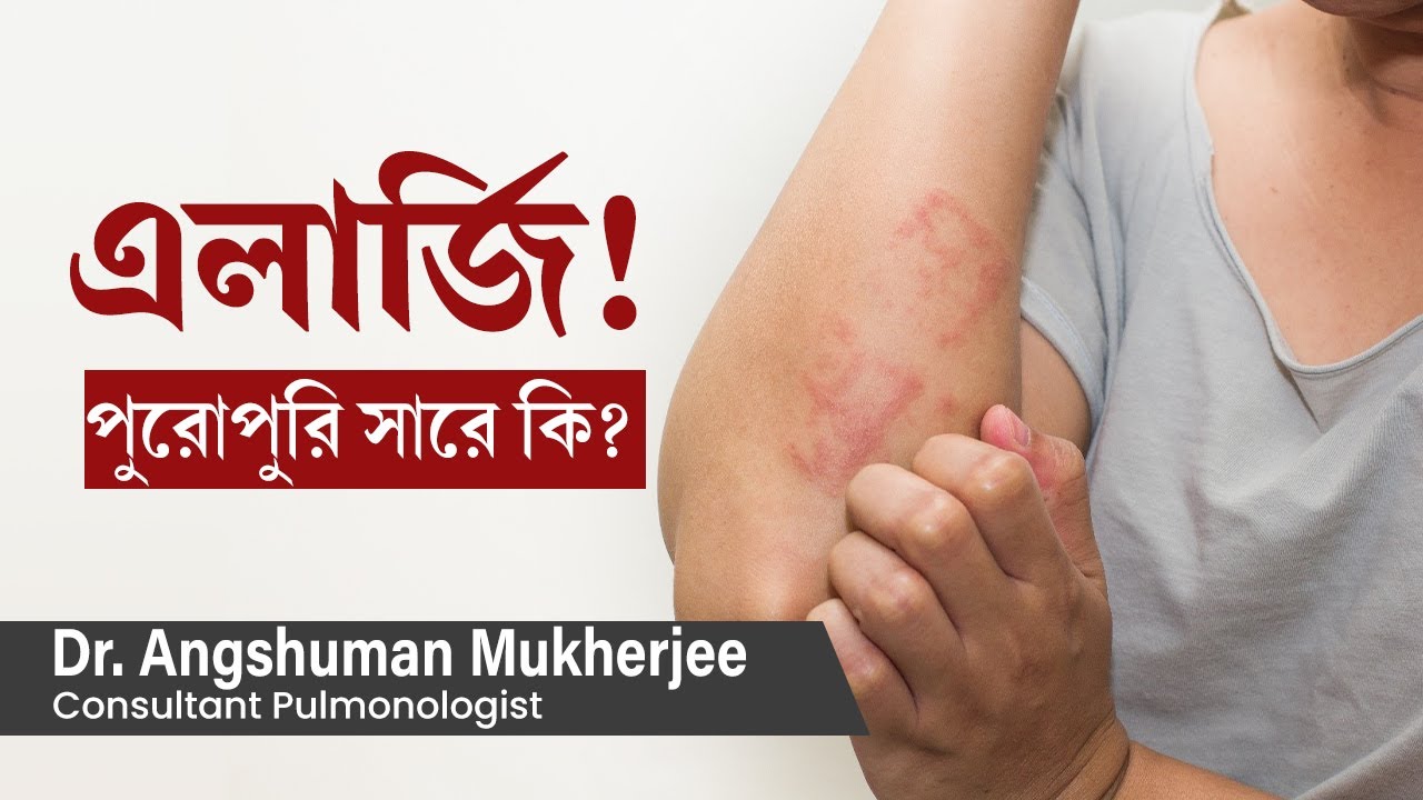 এলার্জি পুরোপুরি সারে কি? এর থেকে মুক্তির উপায় কি | what causes allergy can it be cured permanently