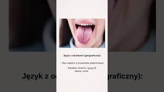 #zdrowie