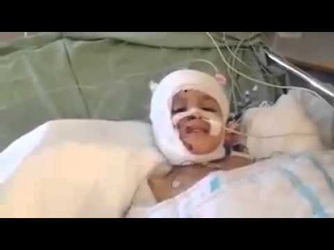 الطفل احمد دوابشة انحرقنا
