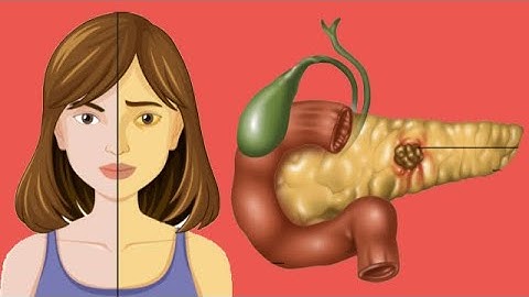 High Bilirubin Levels: Symptoms And Treatment