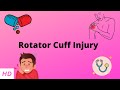 Rotator Cuff Injury: Causes, Signs, Diagnosis & Treatment